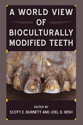 cover -top jaw with gold in front teeth, A World View of Bioculturally Modified Teeth